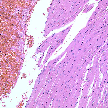 H&E stained mouse heart tissue