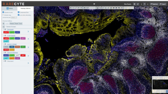 Orion image slide visualized in Artemis Software